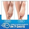 Imperial Feet Urea Foot Balm - Natural Urea Cream for Foot Care, Cracked Heel Repair, Rough Skin, Dryness, Calluses - Cleansing, Exfoliant - Wild Herb Extract - 5.07oz