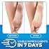 Imperial Feet Urea Foot Balm - Natural Urea Cream for Foot Care, Cracked Heel Repair, Rough Skin, Dryness, Calluses - Cleansing, Exfoliant - Wild Herb Extract - 5.07oz