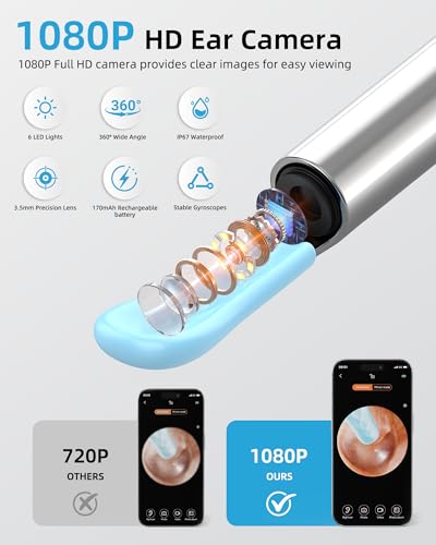 Qimic Ohrenschmalz Entferner mit Kamera, 1080P HD WiFi Otoskop, 3,5mm Linse, 360° Weitwinkel, IP67 Wasserdicht, 6 LEDs, USB-C Aufladung, kompatibel mit iOS & Android - Schwarz