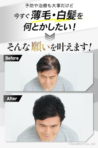 Amazon.co.jp: チャップアップ（CHAPUP）