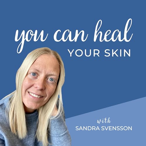 Episode 17: How to manage travelling while healing