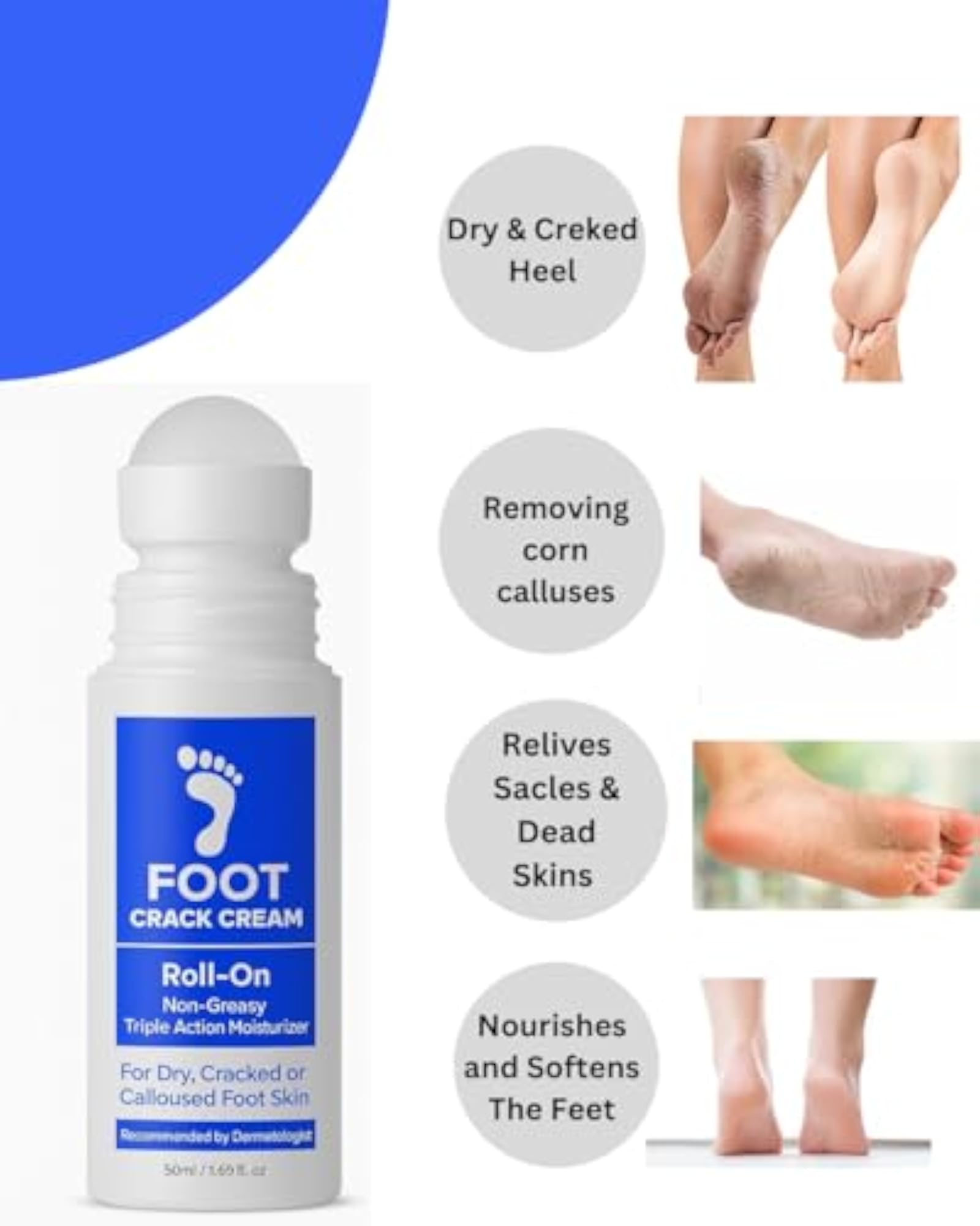 20% Urea Crack Heel Repair Foot Cream Roll On
