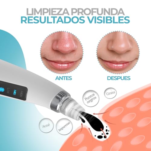 CLINVRA Kit facial 4 pasos: Succionador de Puntos Negros con 5 boquillas + Limpiador Facial Eléctrico + Toalla para abrir poros, extractor y limpiador de poros para casa - imagen 7