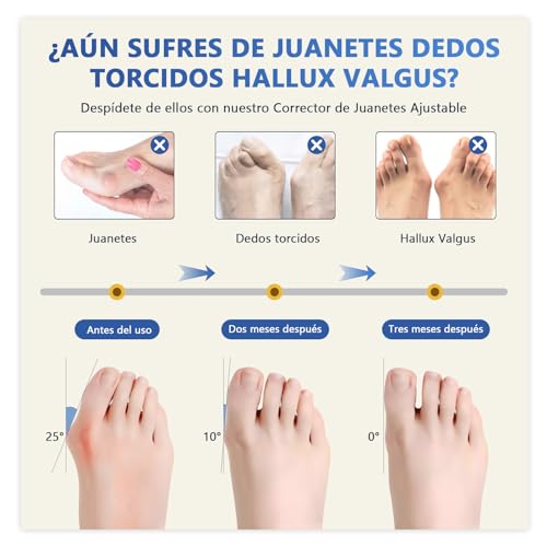 Reviews y listado de Corrector juanetes del mes. 18 Imagen adicional
