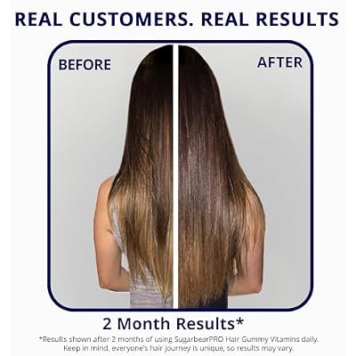 SugarBearPro Batana Hair Oil & Glass-Dropper Applicator, 1oz + Vegan Hair Vitamin Gummies 1 Month Supply, Extra Strength Biotin 6000mcg