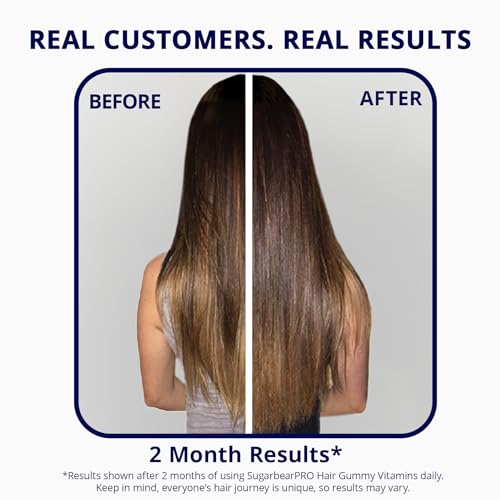 Image of SugarBearPro Hair Vitamin Gummy 35 Day Supply, Extra Strength Biotin 6000mcg for Hair Growth, Vegan Vitamin B12, MSM, Inositol, Omega 3, Elderberry, Certified Kosher, Halal, Cruelty-Free
