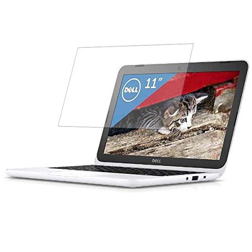 ClearView Dell Inspiron 11 3000(�z���C�g) MI11-7HHBW(2017�N�t���f��) 11.1�C���`�Ή��y���S��5��@�\���Ռ��z���E�u���[���C�g�J�b�g�z�t���ی�t�B���� ���˖h�~�E�R�ہE�C�A���X
