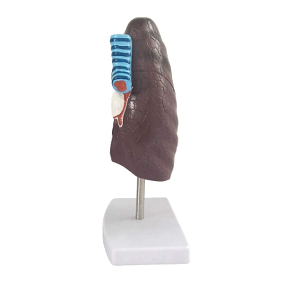 Zusammenbau-Montagemodell, Anatomie-Modell, Lungenorgan, menschliches pathologisches anatomisches Atmungssystem, Modell für Medizin, Biologie, Labor, Wissenschaft, Unterricht, Demonstration für Schul