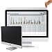 17.0 Inch Privacy Screen Filter for Standard (SQUARE) Monitor (5:4 Aspect Ratio). Best Anti Glare Protector Film for data confidentiality - compare to 3M (17.0)