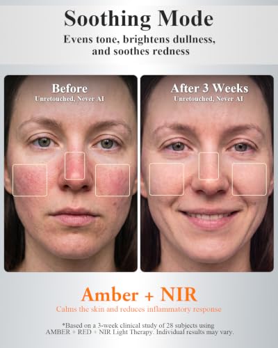 Image of Red Light Therapy for Face, Clinically Tested&FDA-Cleared, All-New2026Model