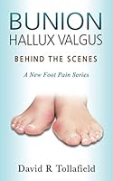 Bunion (Hallux valgus): Behind the Scenes: Foot Pain Series (My Patient Journeys) 1077747616 Book Cover