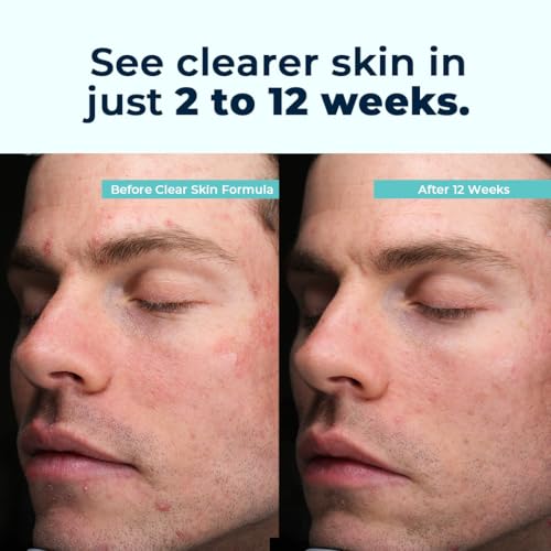 VitaMedica Clear Skin Vitamin Formula