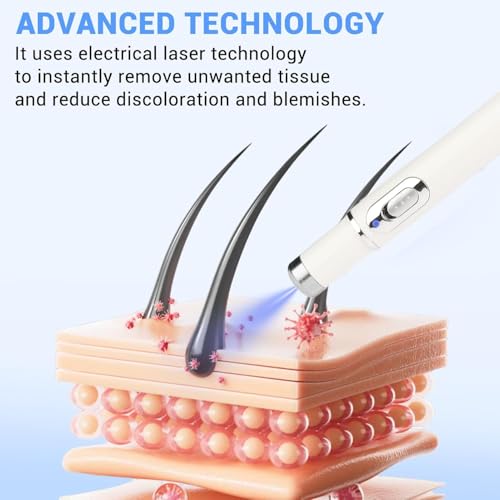 Penna Laser Non Invasiva Per La Rimozione Di Lentiggini E Verruche, Penna Laser Per La Crescita Della Pelle Di Viso E Corpo, Adatta Per La Rimozione Di Verruche, Acne E Nei - 4
