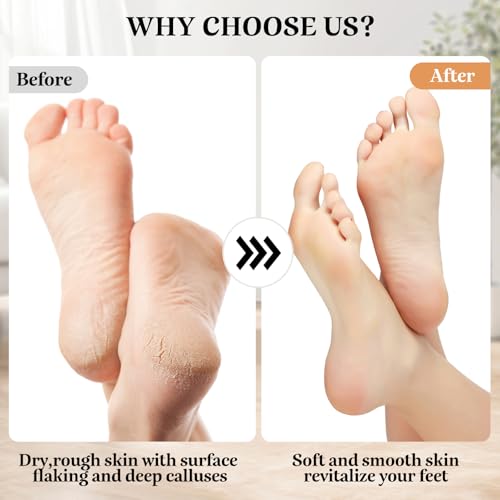 Nuaoi PY02 Electric Callus Remover Foot File - Rechargeable Callus Remover Pedicure Tools For Feet Foot Scrubber File Foot Care Grinder thumb #1