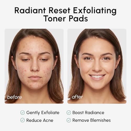Image of MAREE Glycolic Acid Resurfacing Pads - Toner Pads for Face Cleansing - Exfoliating Pad with Tea Tree Oil, Salicylic Acid & Vitamins E, B3, B5 - Acne Treatment Device for Pore Resurfacing - 50 Count