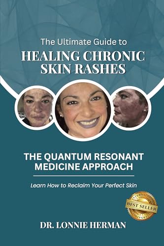 The Ultimate Guide To Healing Chronic Skin Rashes: The Quantum Resonant Medicine Approach - Learn How To Reclaim Your Perfect Skin