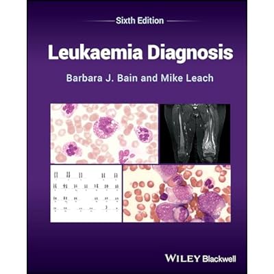 Leukaemia Diagnosis