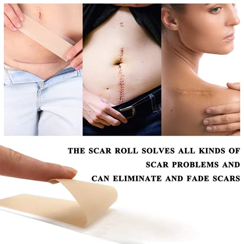 Medical Grade Silicone Scar Sheets, Silicone Scar Tape (1.6”X 60”), Scar Removal Strips For Acne Scars C-Section & Keloid Surgery Scars Sheets Treatment Sheets - 6-8 Month Supply #TOP4