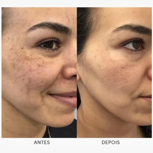 Serum facial Visage D'or Preenchedor e Clareador | SAVIORA