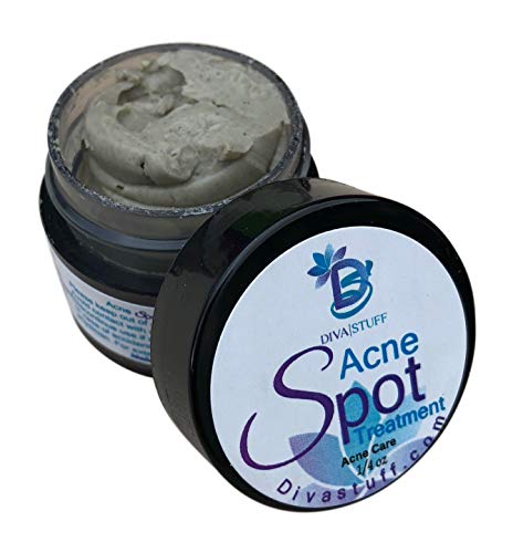 The Best Spot Acne Treatment, Clay Based, By Diva Stuff