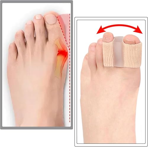 Image of LUVINA Gel Toe Separators for Bunions - Breathable Fabric Toe Spacers with Gel Lining for Bunion Pain Relief & Hammer Toe Correction - 2-Loop Design for Men & Women (2, S + L)