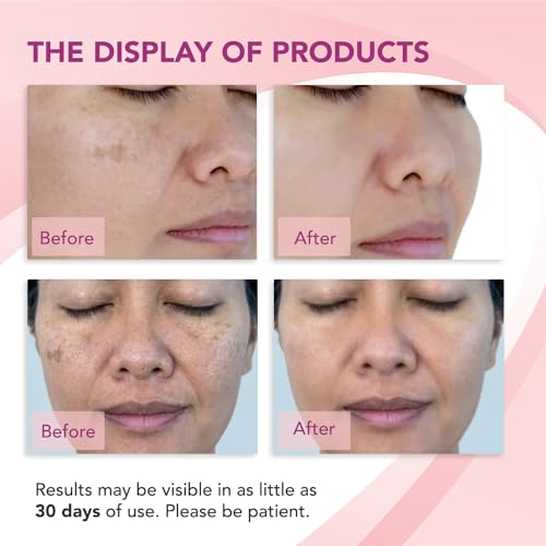 Dark Spot Remover for Face: Faded Dark Spot Correcting Glow Serum - Discoloration Correcting Serum - Dark Spots Corrector Hyperpigmentation Treatment Korean Skin Care with Arbutin and Niacinamide 30ml