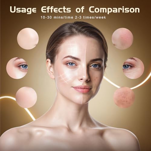 Image of BNU Wireless Red Light Therapy for Face, 4 Modes LED Light Therapy Mask with 400 LED Beads, Dual 1000mAh Remote Control, 850NM Infrared Red Light Therapy for Anti-Aging at Home & Travel