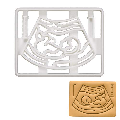 Bakerlogy Pregnancy Ultrasound Scan Cookie Cutter cover