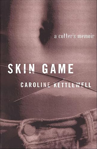 Skin Game: A Cutter's Memoir