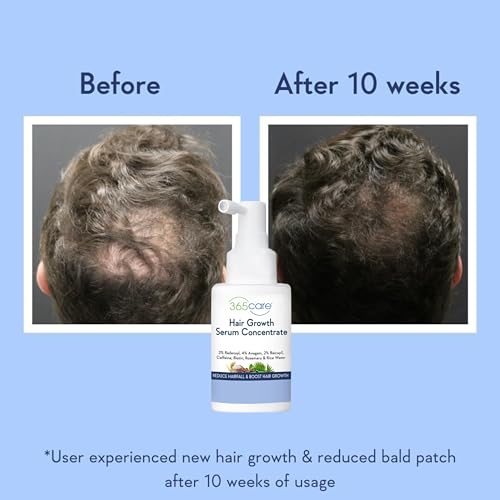 Image of Professional Hair Growth Serum - Strengthens Hair Follicles, Reduces Breakage & Hair Fall - Peptides & Pro-Vitamin B5 - 50ml