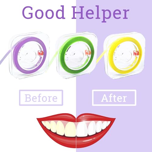 dental polishing strips tooth file teeth sanding grinding tool 3 rolls