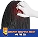 Scalpicin Max Strength Scalp Itch Treatment, 1.5 oz (Pack of 2)