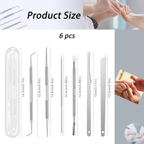 6 PCS Ingrown Toenail Treatment,Ingrown Toenail Removal Kit Under Nail Cleaner Tool Nail Cleaner Tool Toenail Kit Manicure Treatment Pedicure Tools For Feet Under Nail Cleaner Correction Polish Pain