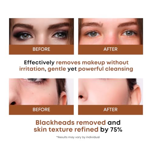 Image of Rice Water Cleansing Pads - Makeup Remover Wipes & Korean Toner Pads with Centella Asiatica, Exfoliating for Blackhead Removal & Pore Minimizer, 50 Pad