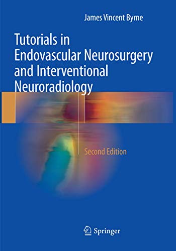 Tutorials in Endovascular Neurosurgery and Interventional Neurora...