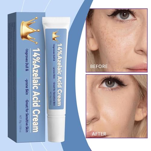 12% Azelaic Acid Serum, sanft und feuchtigungsreich, geeignet für alle Hauttypen, glatte Hautstruktur (1, 3 PC)