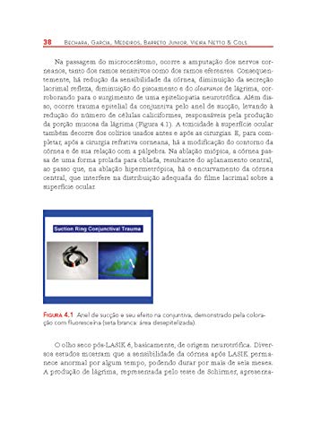 Guia Pratico de Cirurgia Refrativa