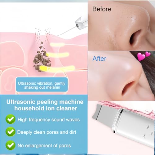 Blackhead remover rechargeable USB pour éliminer les impuretés du visage