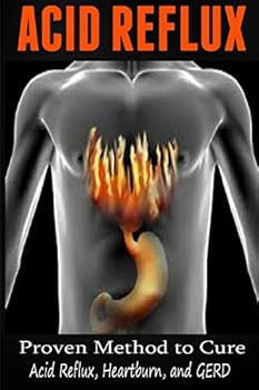 Paperback Acid Reflux: Proven Methods to Cure Acid Reflux, Heartburn, and GERD Book