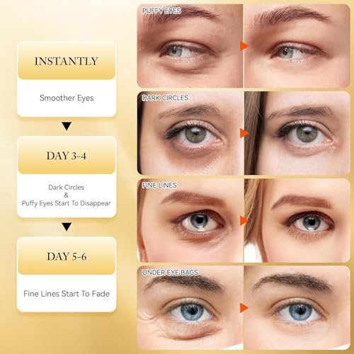 Image of Under Eye Patches for Dark Circles with 24k Gold | Pack of 60 Eye Cooling Gel Pads | Hydrogel Eye Patch Mask with Collagen for Relaxing Eyes, Reducing Puffiness & Wrinkles