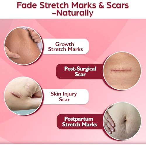 Image of Dr. Veda Stretch Mark Care Roll-On for Women - Skin Repair & Elasticity Booster with Green Tea & Licorice for Stretch Marks, Scars & Smooth Skin | 100% Natural Formula, 30 ml each Pack of 2
