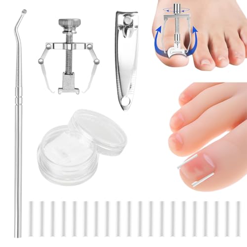 50 tiras alisadoras de uñas indoloras + corrector de uñas encarnadas, kit corrector de uñas encarnadas, levanta uñas, kit de herramientas para uñas fácil de usar