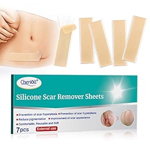 Narbe entfernen, Narbenentfernung,Narbe Behandlung,Narbencreme, Narbenheilungspflaster aus Silikongel Behandeln,Sie neue…