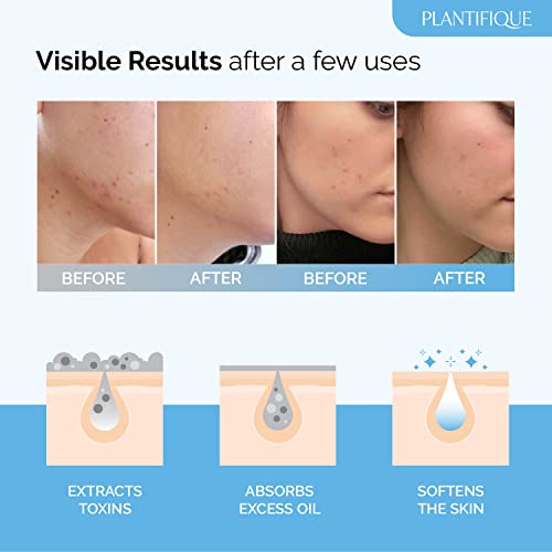 Plantifique Dead Sea Mud Mask For Face Body Care With Hyaluronic Acid For Women And Men thumb #1