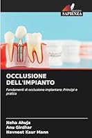 Occlusione Dell'impianto (Italian Edition) 620871575X Book Cover