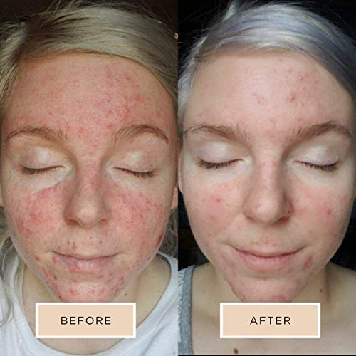 Averr Aglow Luminous Complexion Toner, Face Skincare, Reduce Blackheads Breakouts & Dark Circles, Natural Solution Moisturizing Facial Toner, Hydrating & Soothing Effect #TOP6