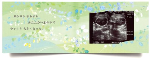 色褪せないエコー写真の保存方法 人気アルバム7選とお得な無料キャンペーン