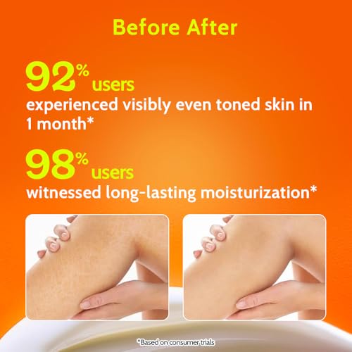 Image of Chemist At Play AHA Body Lotion for Dry Skin | Exfoliates Dead Skin, Deeply Nourishes & Boosts Radiance | With 5% Natural AHA, Niacinamide & Shea Butter | Skin Brightening & Moisturising Lotion- 473ml