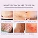 Scarlette Collagen Tape, Scarlette Collagen Sheets for Scars & Wrinkle, Silicone Scar Removal Strips for Various Different Scars and Wrinkles,Reusable（C-Section, Burn, Acne, Surgical Scars） (2pcs)