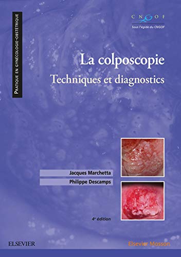 La colposcopie: Techniques et diagnostics (Pratique en gynécologie-obstétrique) (French Edition) La colposcopie: Techniques et diagnostics (Pratique en gynécologie-obstétrique) (French Edition)